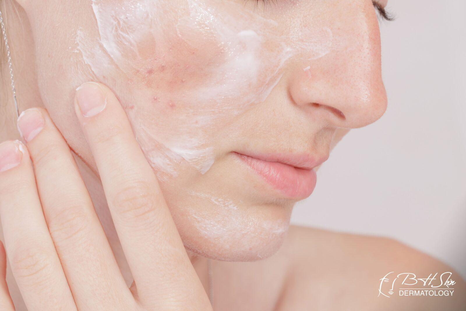Take this quiz to find the perfect soap for your acne-prone skin based on expert dermatologist insights!