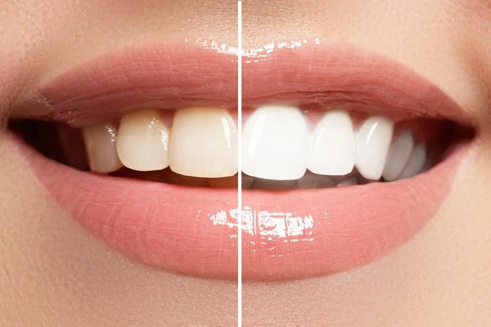 Take this fun quiz to find out which dental health product will best suit your needs for a stunning smile!