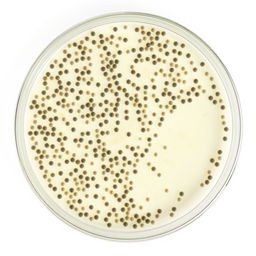 An overhead view of a petri dish containing a Zone of Inhibition experiment