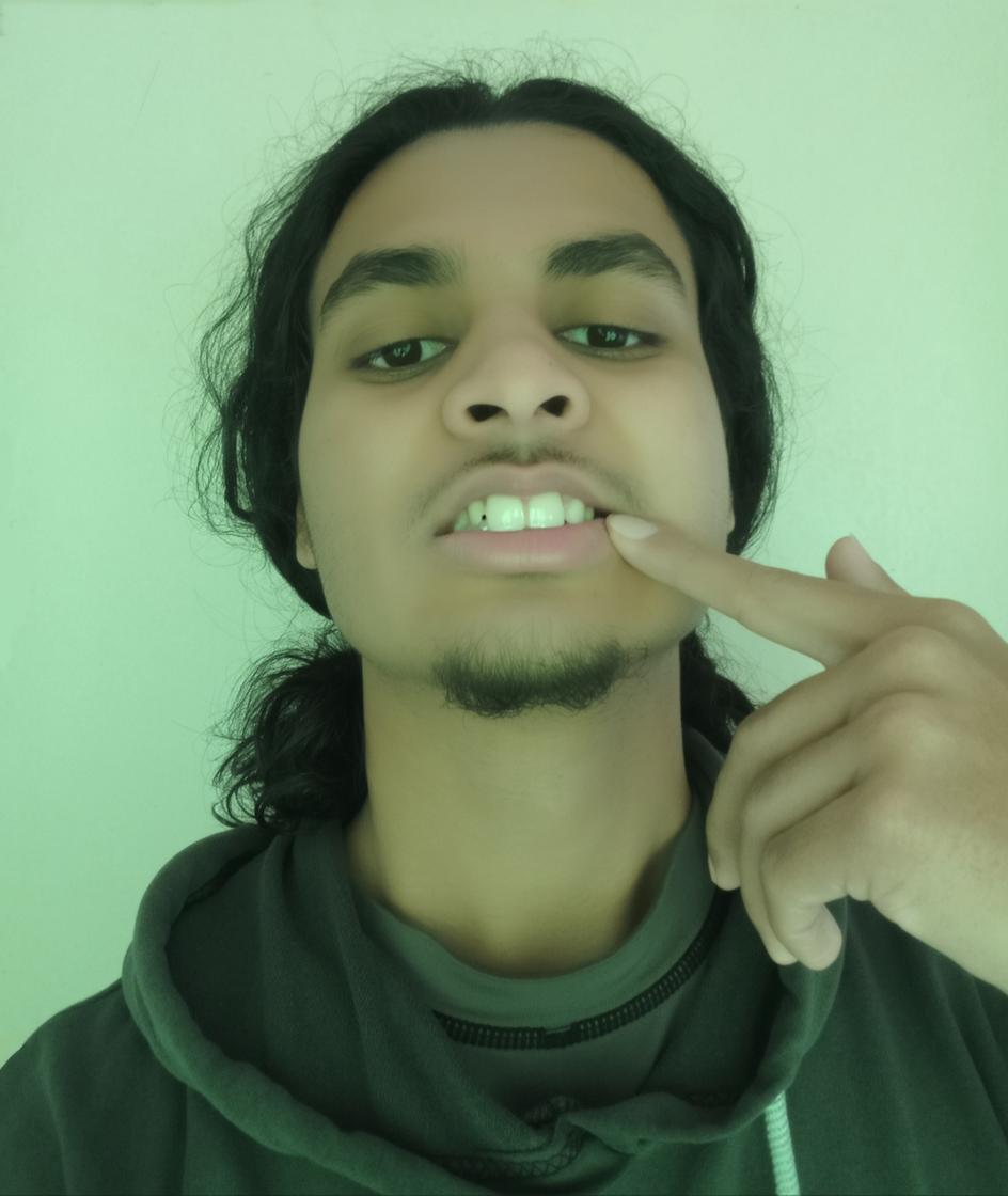 a young man with long hair in a green-tinted room, wearing a gray hoodie, playfully pointing at his mouth, showcasing bright white teeth with flashy gold grillz on his upper teeth, confident facial expression