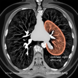 Detailed Chest CT Scan Illustration: No Contrast