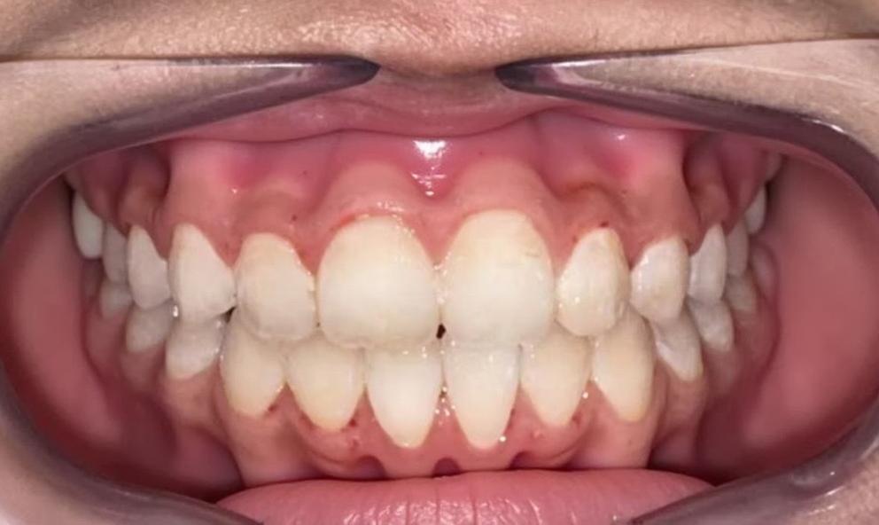 A detailed digital scan of a human mouth, showcasing an open dental cavity with a focus on the teeth and gums
